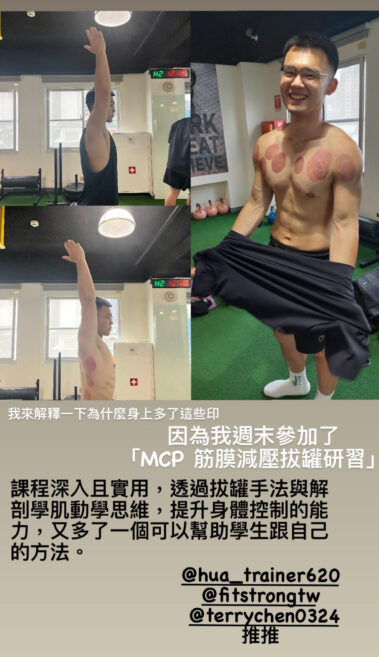 Mcp 筋膜減壓:軟拔罐:研習心得514