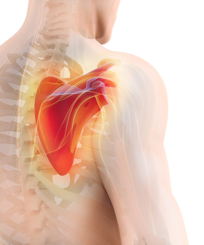 肩膀卡卡？可能肩胛骨壞掉了